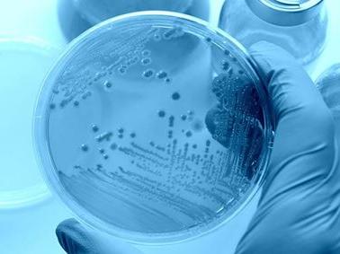 Antimicrobial testing